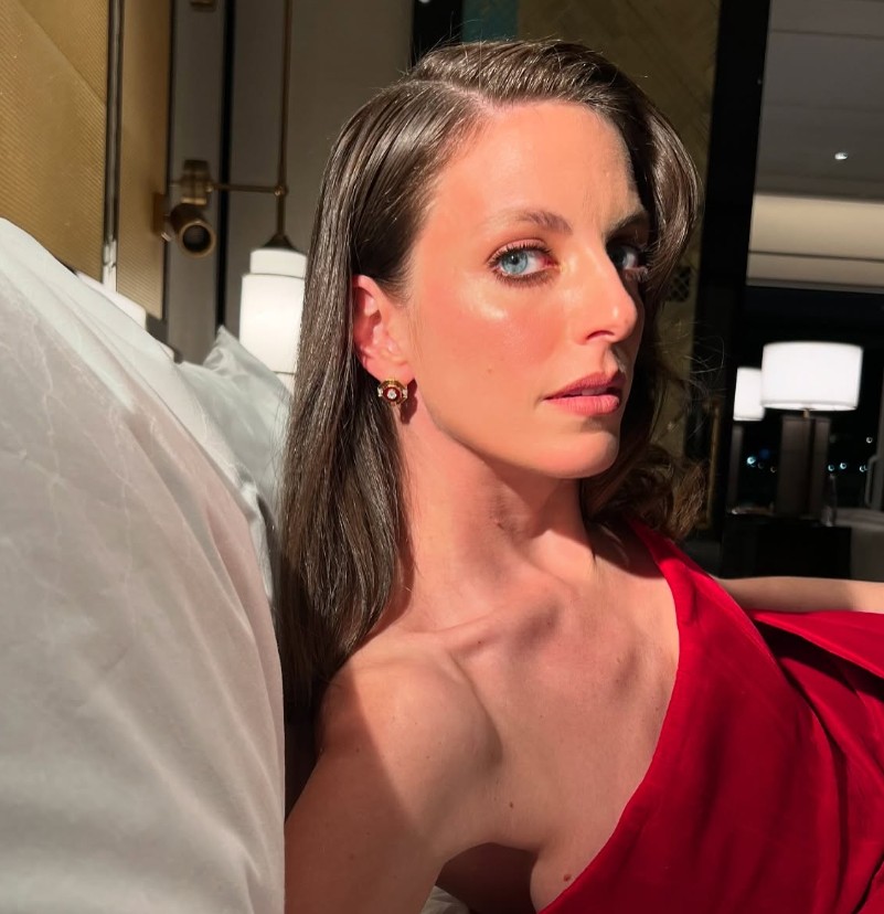 Unlu Oyuncu Bige Onali Akrep Soktu Hastaneye Kaldirildi (1)