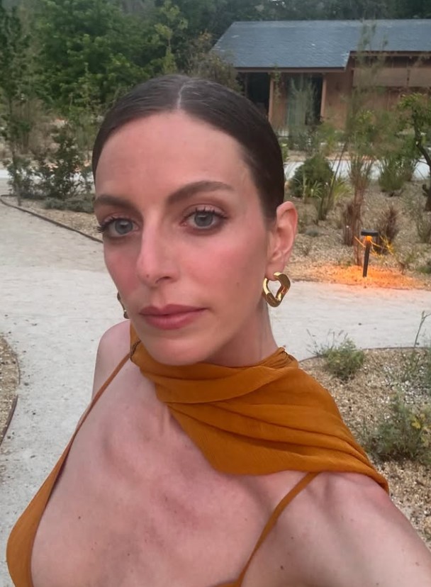 Unlu Oyuncu Bige Onali Akrep Soktu Hastaneye Kaldirildi (2)