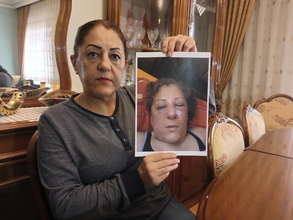 Besledigi Kediler Nedeniyle Komsulari Darp Etti1