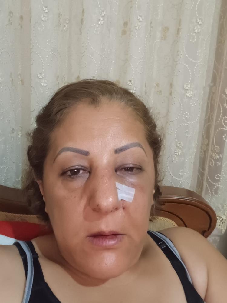 Besledigi Kediler Nedeniyle Komsulari Darp Etti2