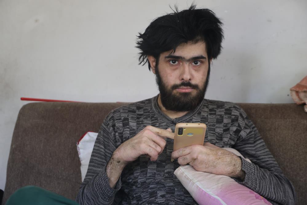 Telefon Bagimlisi Genc 3 Yildir Evden Disari Adim Atmadi1