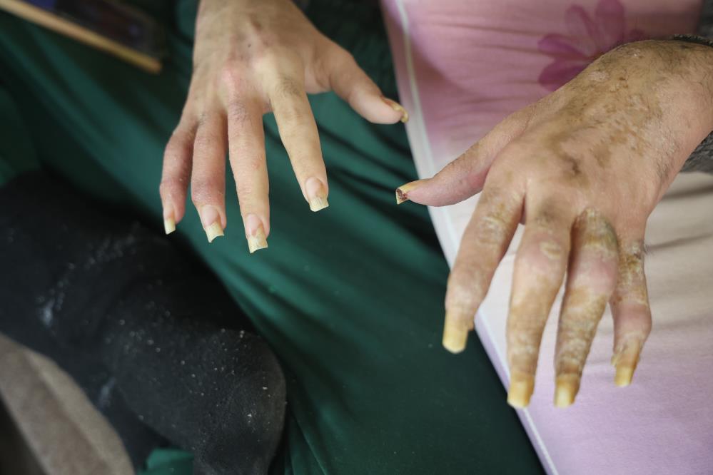 Telefon Bagimlisi Genc 3 Yildir Evden Disari Adim Atmadi3