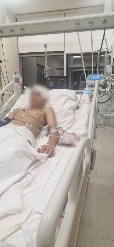 Akran Zorbaligi Dehseti 13 Yasindaki Cocugun Kafatasi Titanyumla Onarildi1