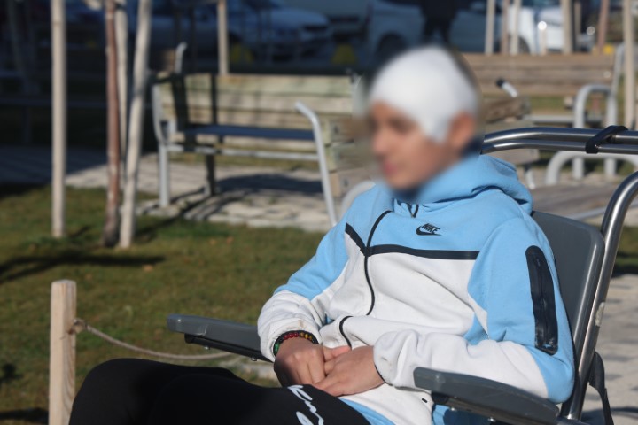 Akran Zorbaligi Dehseti 13 Yasindaki Cocugun Kafatasi Titanyumla Onarildi2