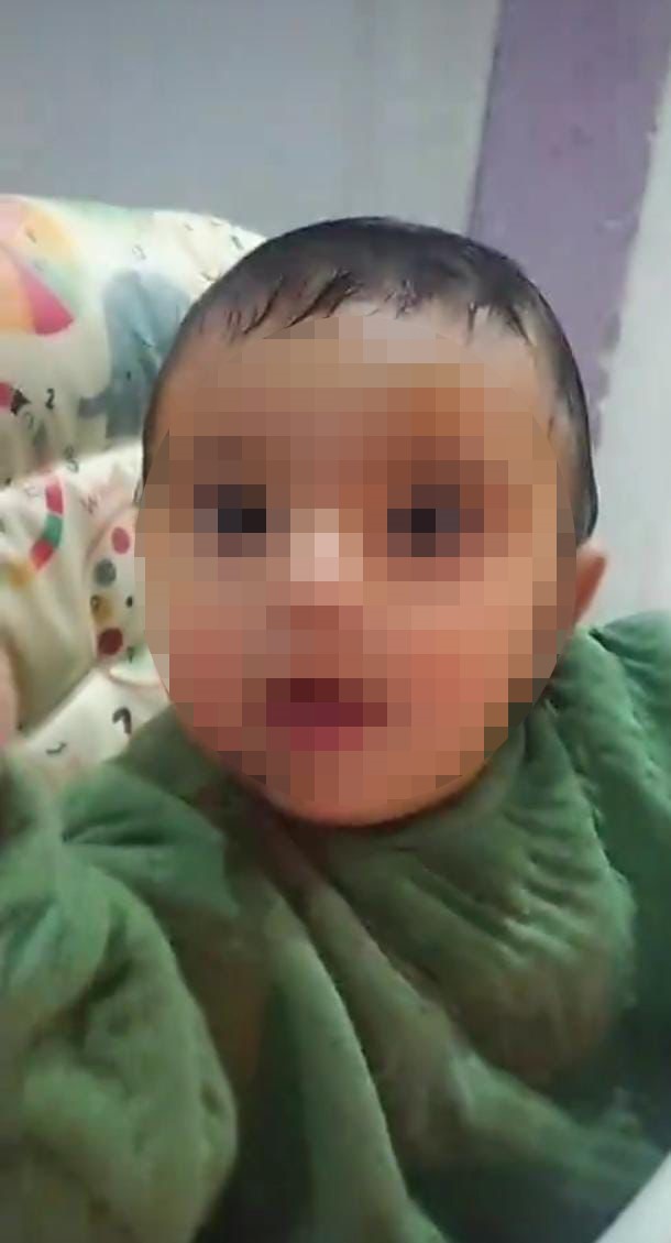 Kan Donduran Olay Siddet Goren 75 Aylik Bebek Agir Yarali (5)