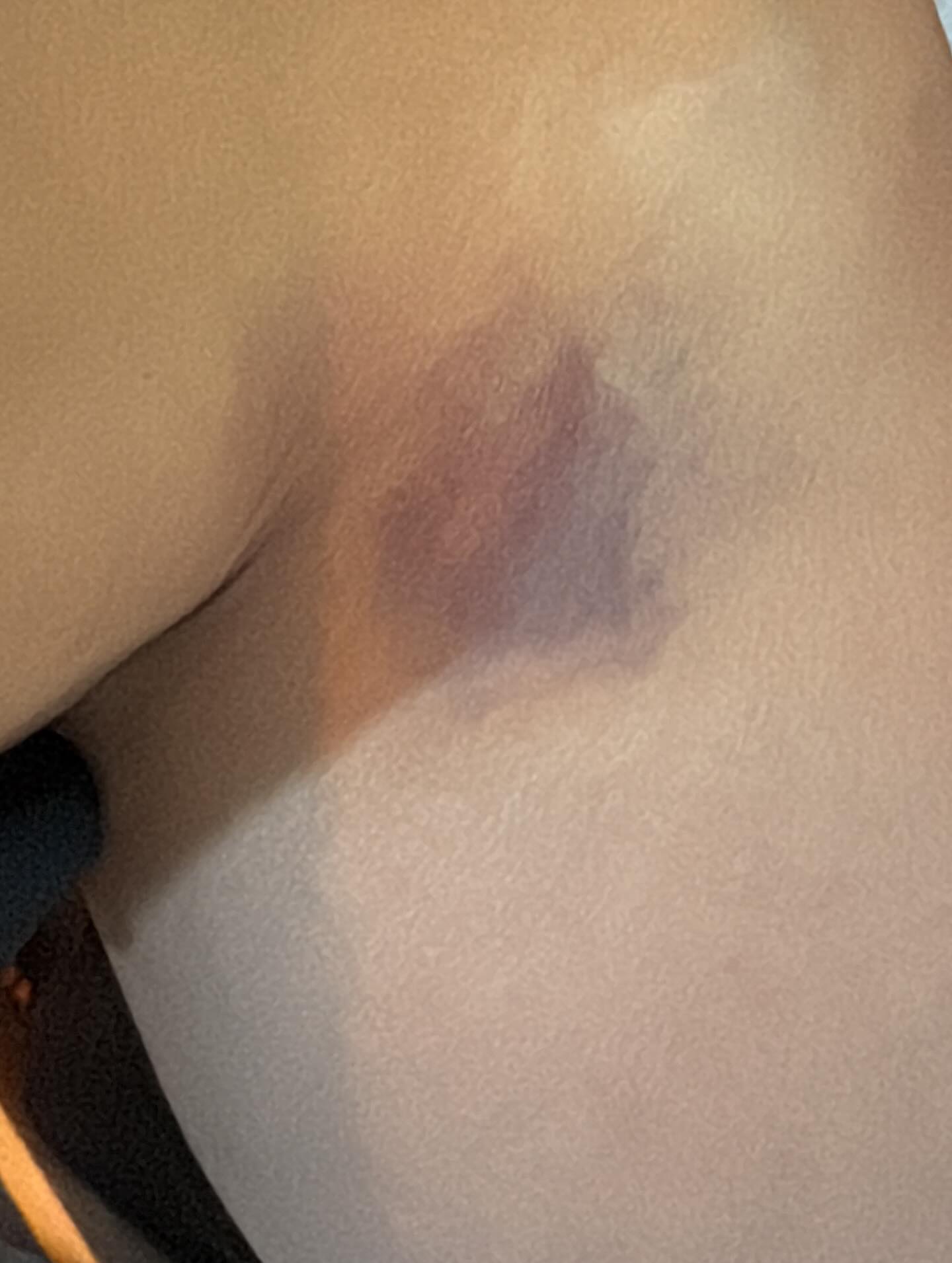 Yildiz Asyalidan Sarsici Paylasim Esim Tarafindan Darp Edildim (1)