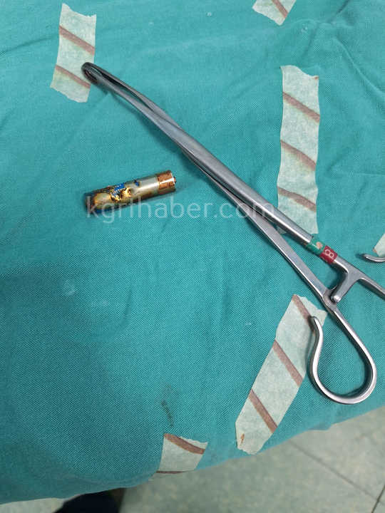 Kumanda Pili Yutan 6 Aylik Esma Bebek Hayata Boyle Tutundu5