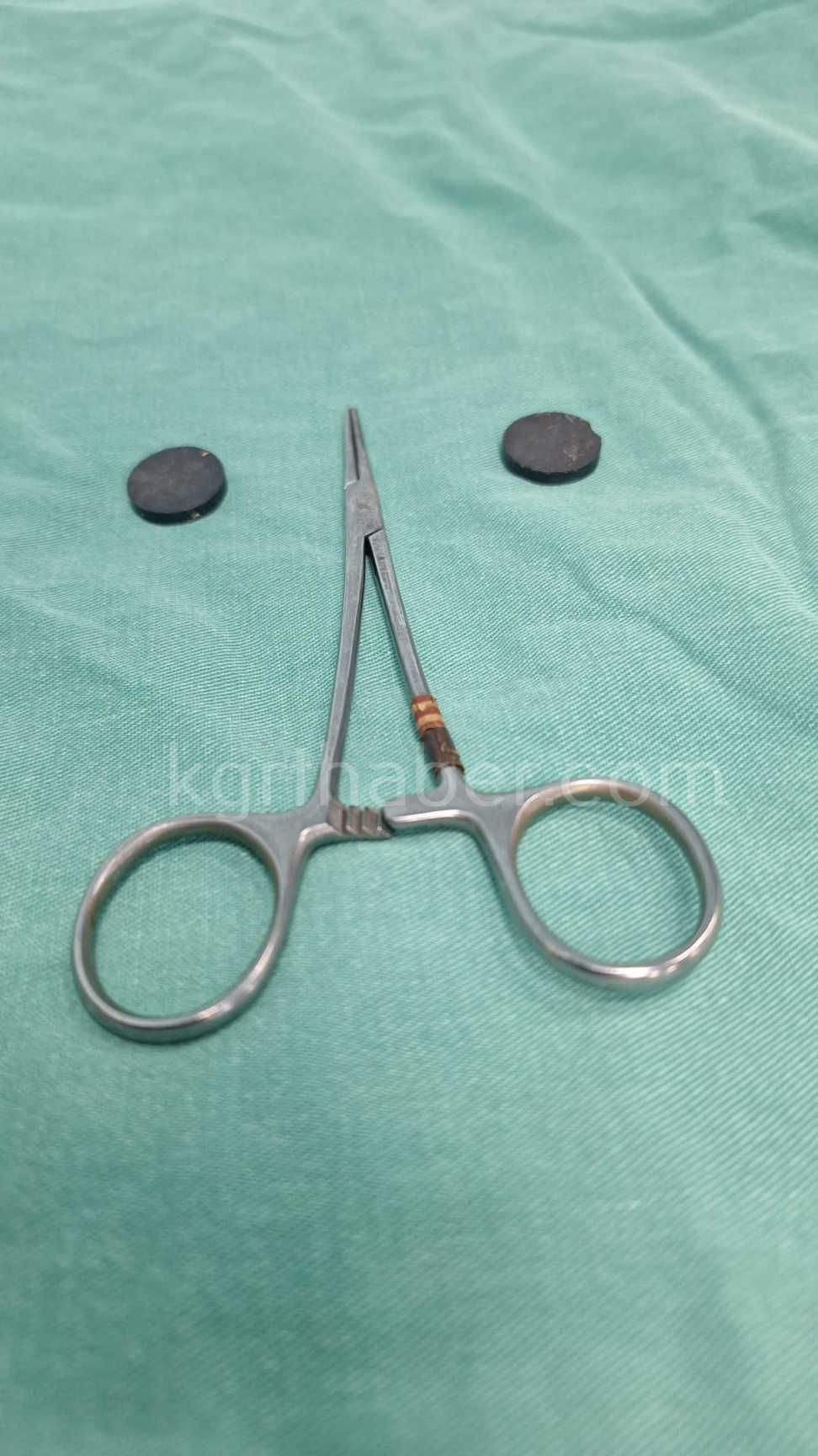 4 Yasindaki Cocuk Cift Miknatis Yuttu Ameliyatla Sagligina Kavustu2