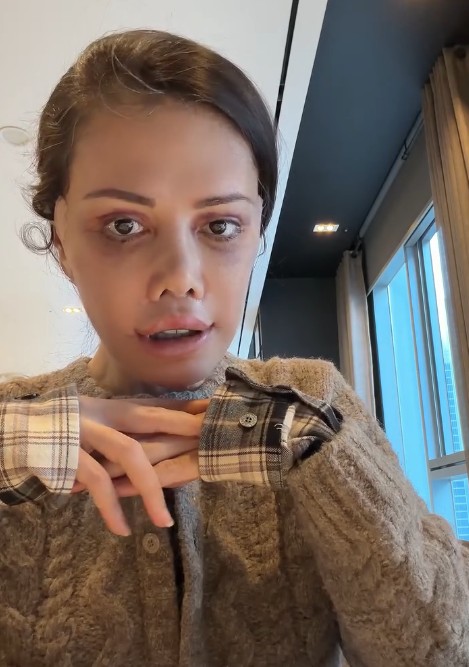 Didem Ceran Kimdir Yuz Ameliyati Neden Gundem Oldu (1)