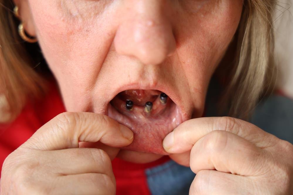 Dis Agrisiyla Gittigi Klinikte 1 Gunde 25 Disi Cekildi2