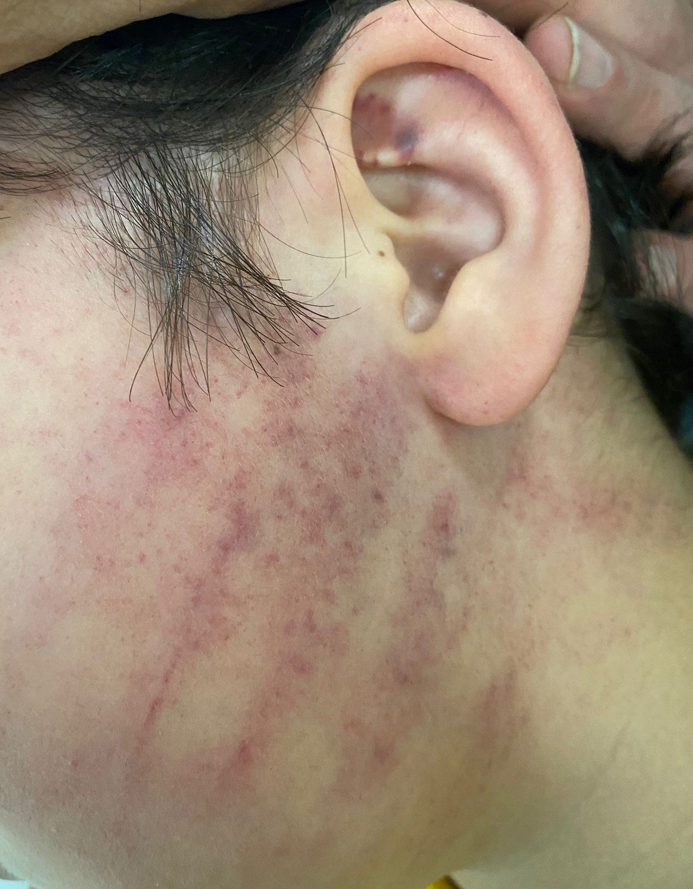 Konyada Skandal Olay Okula Gelen Aile 8 Yasindaki Iki Cocugu Darp Etti (3)