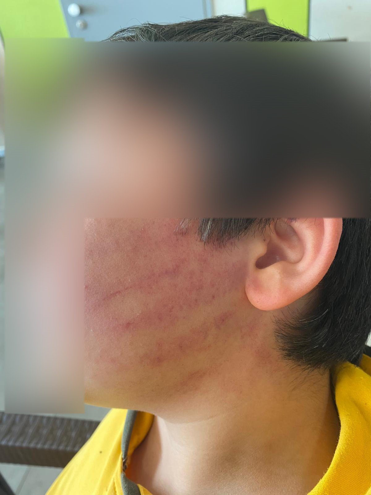 Konyada Skandal Olay Okula Gelen Aile 8 Yasindaki Iki Cocugu Darp Etti (4)