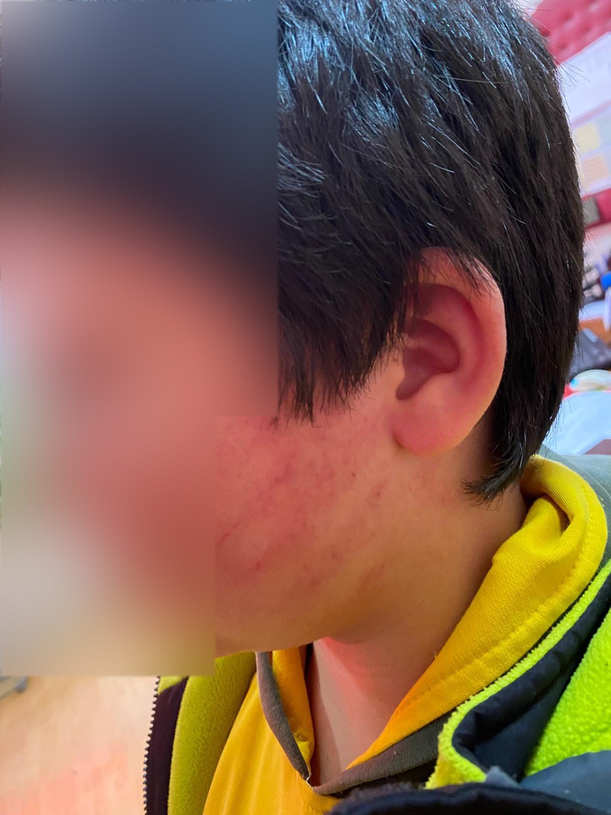 Konyada Skandal Olay Okula Gelen Aile 8 Yasindaki Iki Cocugu Darp Etti (5)