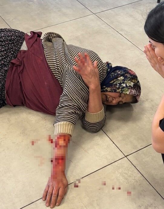 Tekmelere Ragmen Durmadi Kopek Saldirisinda Kadin Agir Yaralandi (1)