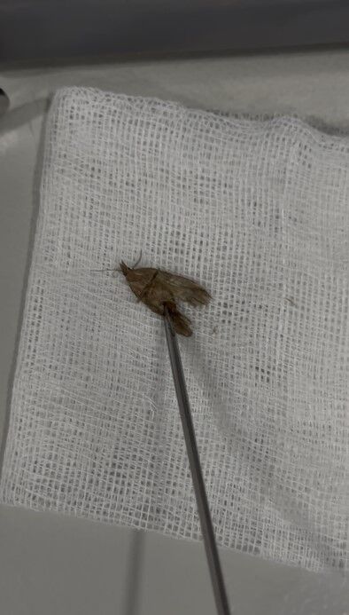 Kulagindaki Hareketin Sebebi Sasirtti Bakin Doktor Ne Cikardi1